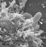 Ein Partikel von Alphaorpheovirus massiliense (Pfeil), bereits im Kontakt mit einer Wirtszelle (Vermamoeba vermiformis)