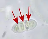 Querseptierte Spore der Zerfließenden Gallertträne (Dacrymyces stillatus)