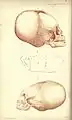 Lithographie von James Basire: (1842) Schädel von Kleinkindern die als Titicacatianer klassifiziert wurden; veröffentlicht im Journal of Natural History.