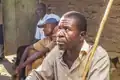 Von Onchozerkose Betroffener in Kamerun