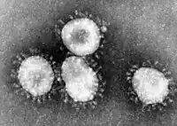 Virion des Coronavirus