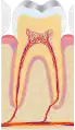 Zahn im Knochen des Alveolarfortsatzes verankert