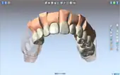 DentCAM