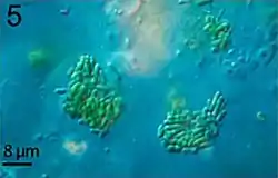 Mikroskopische Aufnahme von Synechococcus sp.
