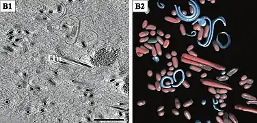 Lange gefüllte Tubuli (fTu) und von Membranen umhüllte Virionencluster. Balken 500 nm
