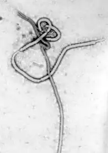 Links: Ebolavirus, Rechts: Pockenvirus