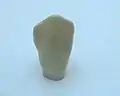 Eckzahn von vestibulär (lippenseitig)