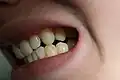 offen