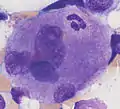 Neutrophiler Granulozyt in einer Megakaryozyte