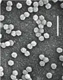 EM-Aufnahme von Virionen des Gelb­ver­zwergungs­virus PAV (BYDV-PAV)