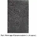 Mikroskopaufnahme reifer Eier von Gongylonema neoplasticum