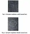 Ein männliches (oben) und ein weibliches (unten) Exemplar von Gongylonema neoplasticum