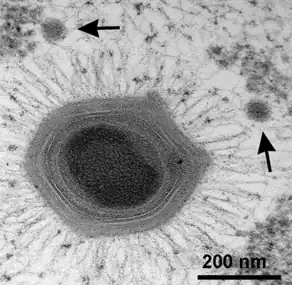 Ein Virusteilchen (Virion) von Mimivirus mit zwei kleineren Virionen des Sputnik Virophagen (Pfeile).