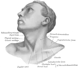 Oberflächenanatomie des M. sternocleidomastoideus (bei einem an einem Torticollis Erkrankten)