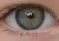 graues Auge