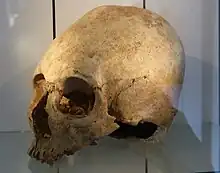 Künstlich deformierter Schädel ( 500.n. Chr. ) eines Hunnen/Ostgermanen, aus einem Grab in Regensburg-Irlmauth
