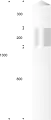 J1: Kurve