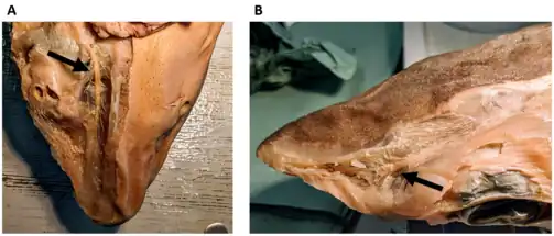 Kopfbereich eines Dornhais (Squalus acanthias) mit abgezogener Haut. A, Ansicht von unten; zu erkennen ist der Ramus buccalis des vorderen Lateralisnervs (Pfeil) und die von ihm abgehenden Nervenfaserbündel, die zu den Lorenzinischen Ampullen ziehen. Diese wurden auf der linken Seite des Fotos, zusammen mit der Haut, abpräpariert. Auf der rechten Seite des Fotos ist das ventrale Porenfeld noch gut zu erkennen. B, Ansicht von oben; zu erkennen ist der Ramus superficialis ophthalmicus des vorderen Lateralisnervs (Pfeil) und die von ihm abgehenden Nervenfaserbündel, die zu den Lorenzinischen Ampullen des dorsalen Ampullenfelds ziehen. (Foto: Simon Bauerle)