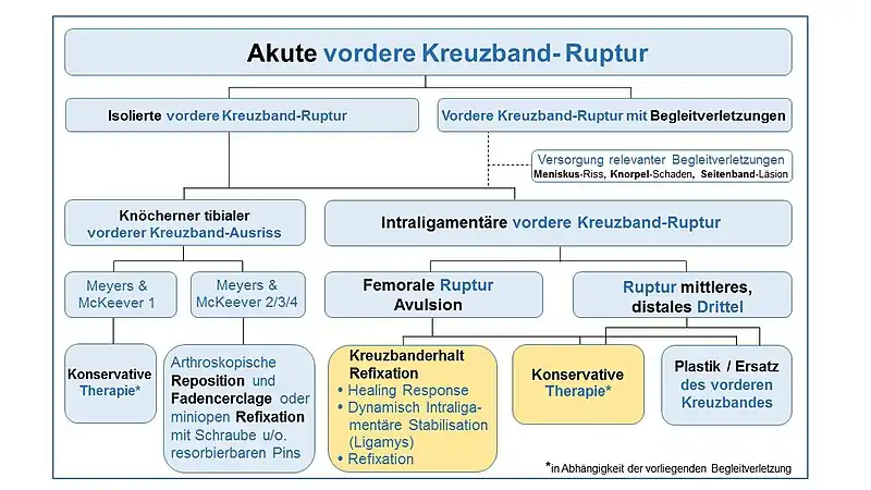 Schema Optionen bei akuten vorderen Kreuzband-Rupturen