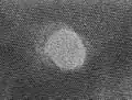 Latente-Ionenspur in Glimmer. Je nach der Bremskraft des Projektilions liegt der Spurdurchmesser zwischen 4 und 10 Nanometern.