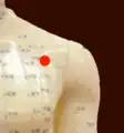 Lu 1