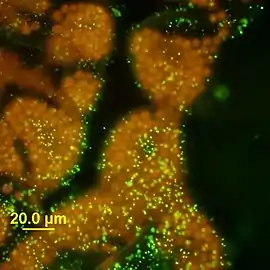Kolonie von Microcystis wesenbergii unter dem Epifluoreszenzmikroskop, DNA mit SYTOX grün gefärbt