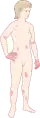 Jugendlicher