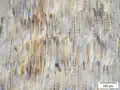 Mikroskopierter polarisierter Radialschnitt (Sichtbarkeit der Kristalle) (100 nm)
