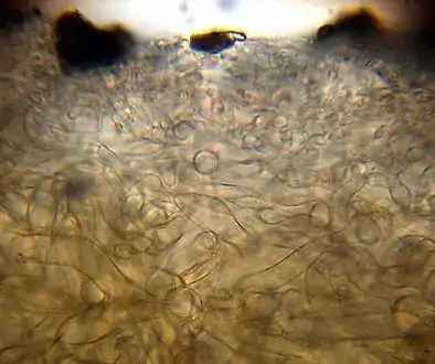Cuticula des Hutes
