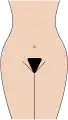 Bikini Lines