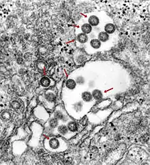 Behüllte Partikel des Rifttalfieber-Virus (Bunyaviridae) im Lumen des ER