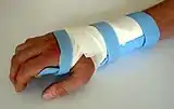 Klettverschluss an einer Armschiene