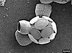 Scyphosphaera apsteinii(Zygodiscales)