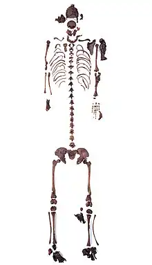 Skelettteile der Moorleiche Mädchen aus dem Uchter Moor