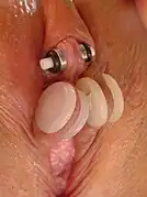 Klitoris- undSchamlippen-piercings