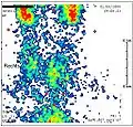 Schilddrüsenszintigrafie bei Subakuter Thyreoiditis: verminderter Uptake.