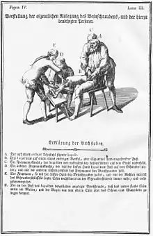 Anlegen der Beinschrauben