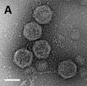 Negativ einer EM-Aufnahme gereinigter Sputnik-Virophagenpartikel. (Balken 500 nm).