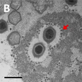 TEM-Aufnahme von Sputnik-Virionen, die an Mimivirus-Fibrillen gebunden sind. (Balken 500 nm).