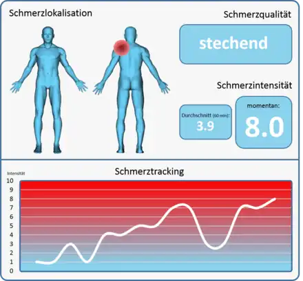 Exemplarische Vision eines Schmerzmonitoring-Screens. Visionär sollte ein Schmerzmonitoringsystem in der Lage sein, dem Kliniker alle relevanten Informationen (Lokalisation, Qualität, Intensität, Verlauf) über den aktuellen Schmerz des Patienten in effektiver Darstellung zu liefern.
