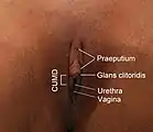 Glans clitoridis mit kleinem Abstand zur Öffnung