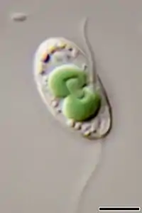 Dito, aber nur 1 Cyanelle in Teilung.Balken: 5 µm(W. Bettighofer)