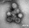 Humanes Coronavirus NL63