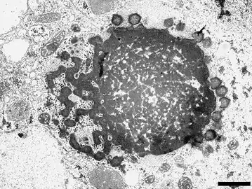 Nachkommenschaft des „Sputnik 3“ Virophagen, produziert in einer Virusfabrik (VF) von Gruppe-A-Mimiviren. Balken 1 µm.