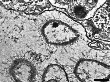 „Sputnik 3“-Virophagen, produziert in einer VF von Moumouvirus (Gruppe-B-Mimiviren). Balken 200 nm.