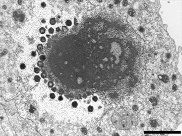 „Sputnik 3“-Virophagen, produziert in einer VF von Courdo11 (Spezies Megavirus chilensis, Gruppe C-Mimiviren). Balken 2 µm.