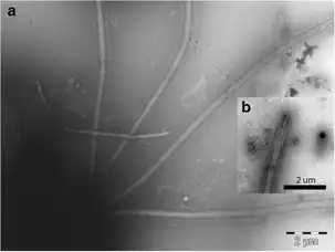 C. triciliatum Å85 (Detail).a: Die vier Geißeln,b: Spitze einer Geißel.