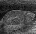 Sonographie: Hund mit abdominalem Kryptorchismus und Aszites (links: Hoden, rechts: Nebenhoden)