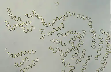 Anabaena circinalis