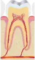 Zahn im Knochen des Alveolarfortsatzes verankert